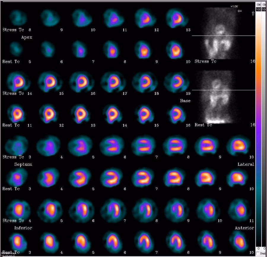 Quanto tempo demora a fazer uma cintigrafia?