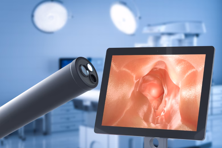 Qual é a preparação para endoscopia e colonoscopia?