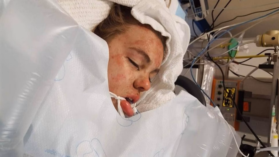 Quanto tempo podemos estar em coma induzido?