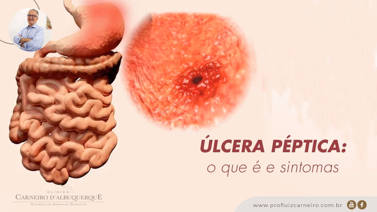 Como tratar úlceras de pressão em idosos?