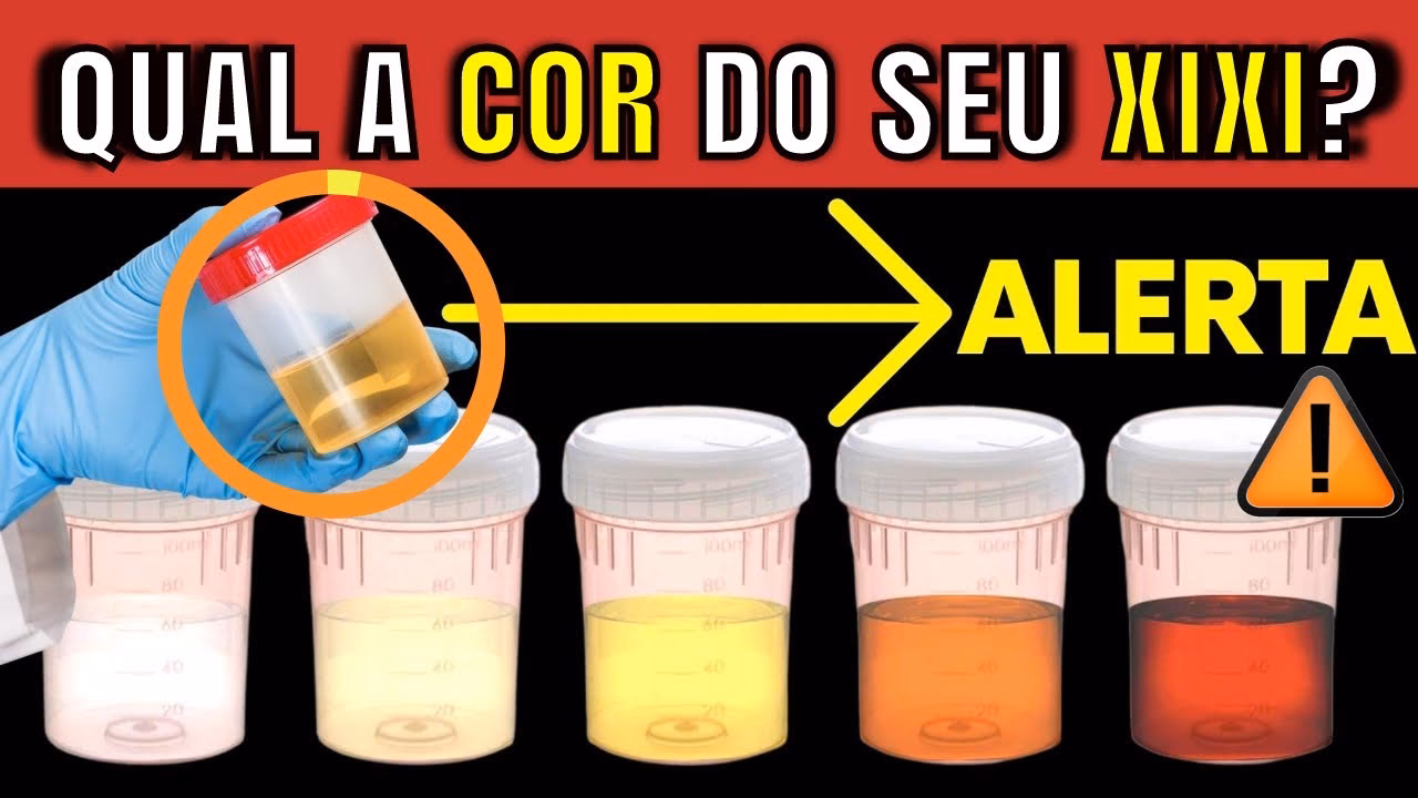 Qual é a cor de uma urina saudável?