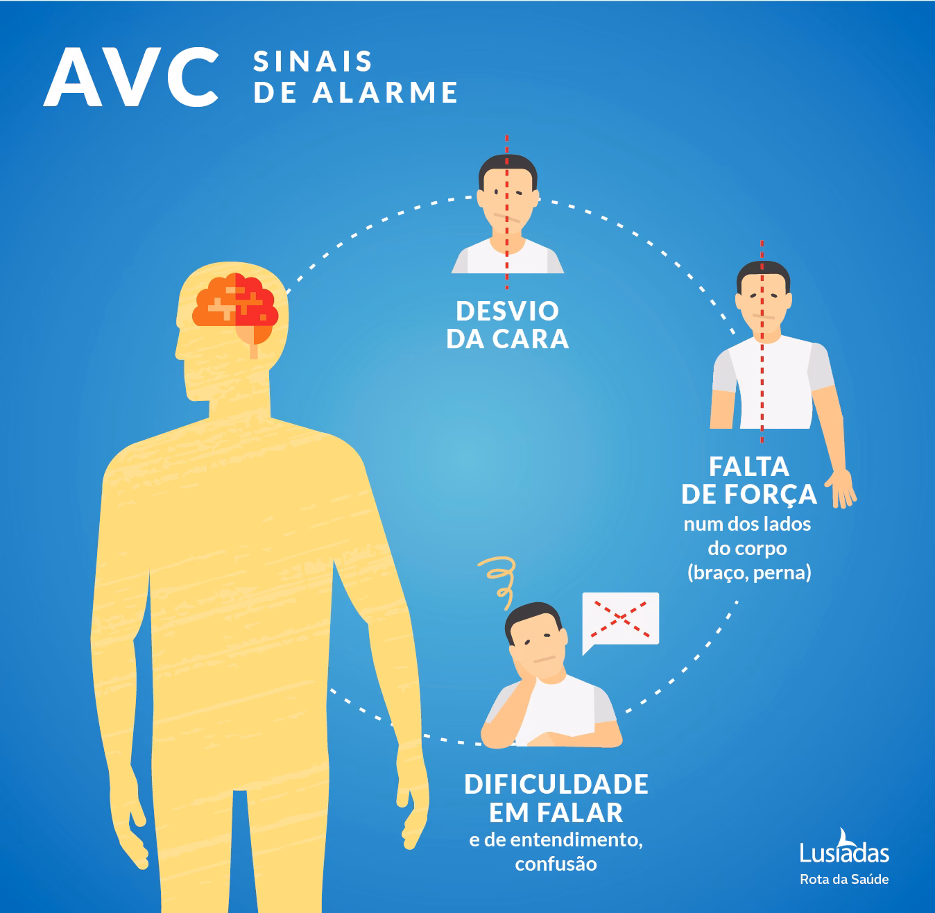 São sinais de alerta de um possível AVC?