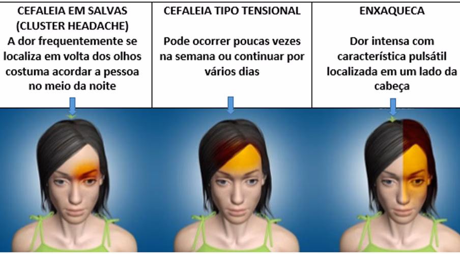 Porque é que a minha cabeça não pára de doer?