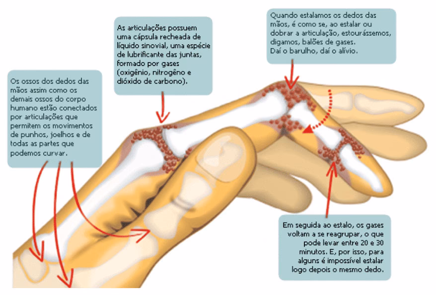 Faz bem ou mal estalar os ossos?