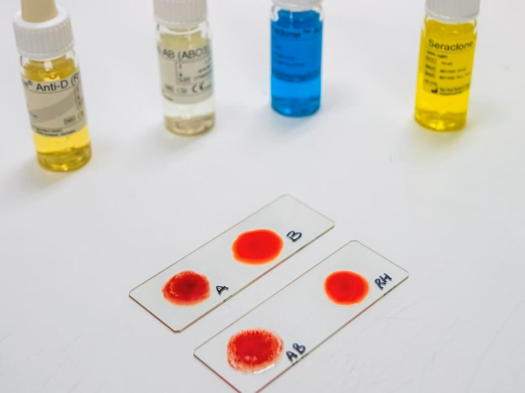 Como saber o grupo sanguíneo do bebé?