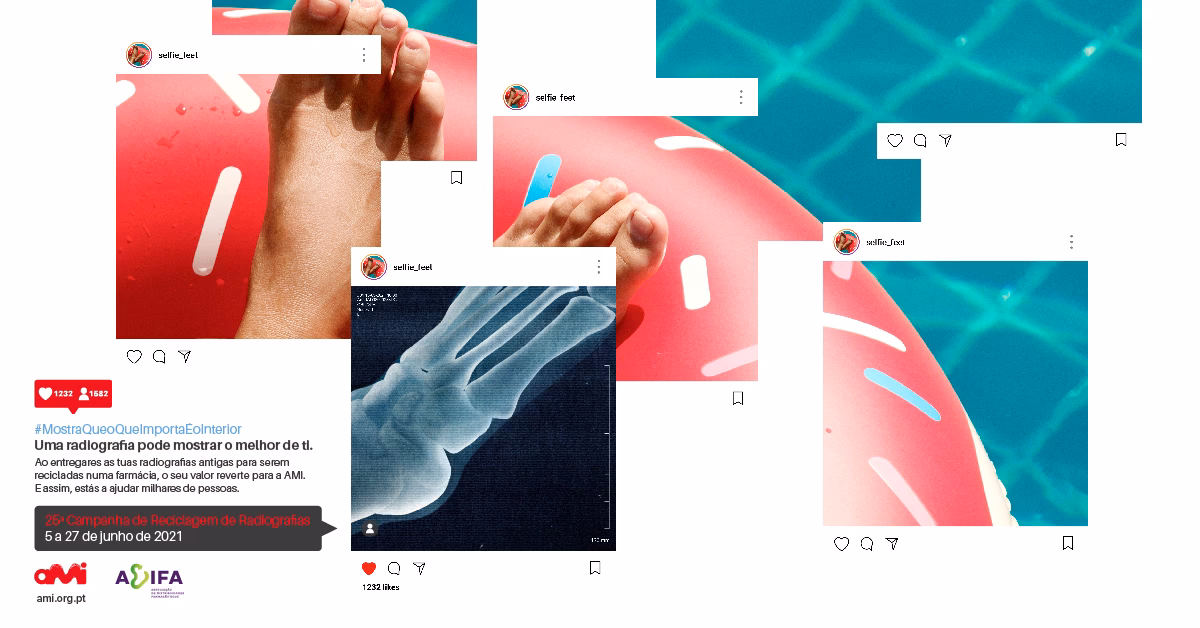 Onde descartar películas de RX?