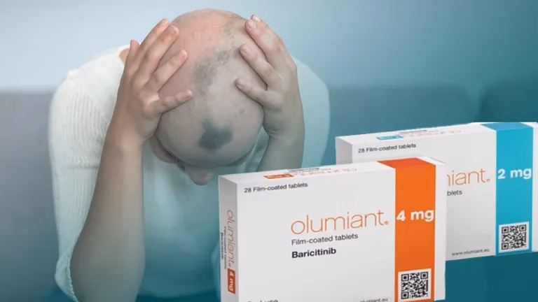 Qual é o tratamento para a alopecia?
