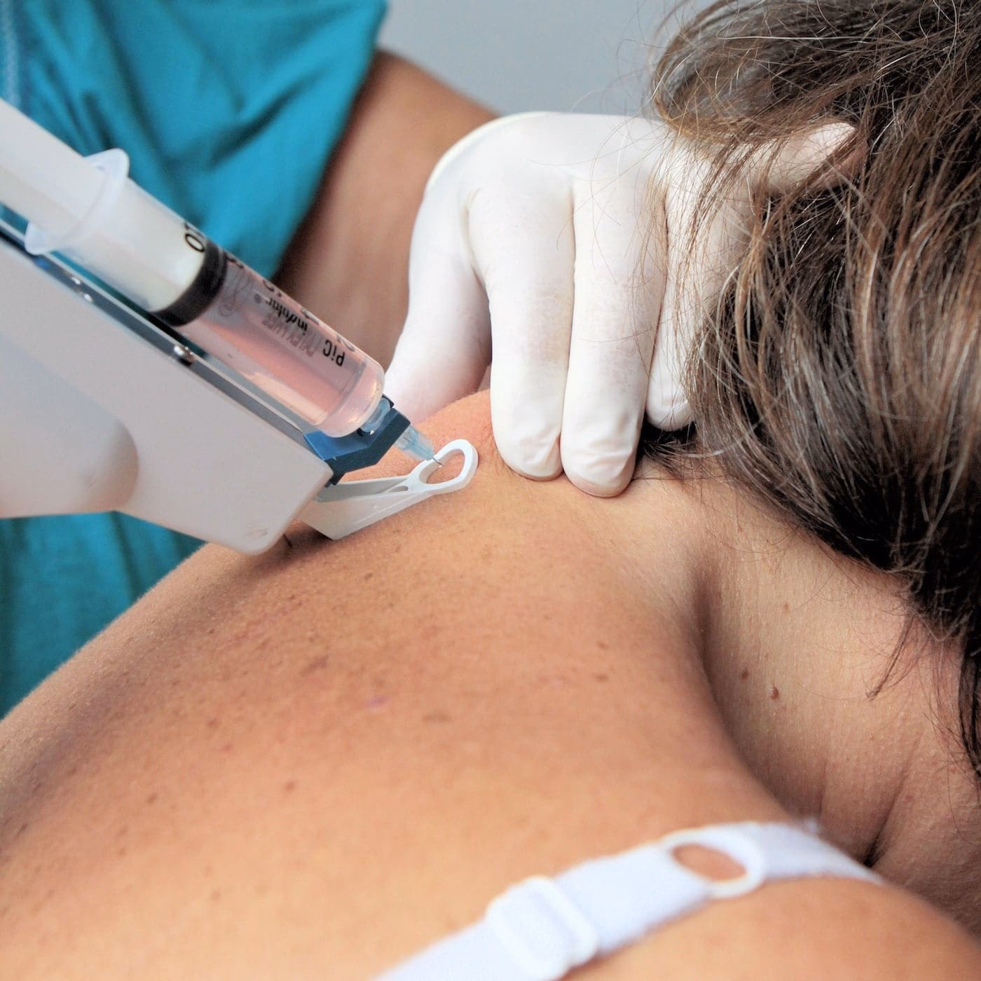 O que é mesoterapia homeopática?