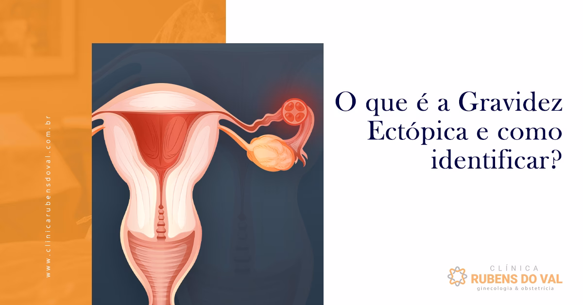 É possível engravidar depois de uma gravidez ectópica?