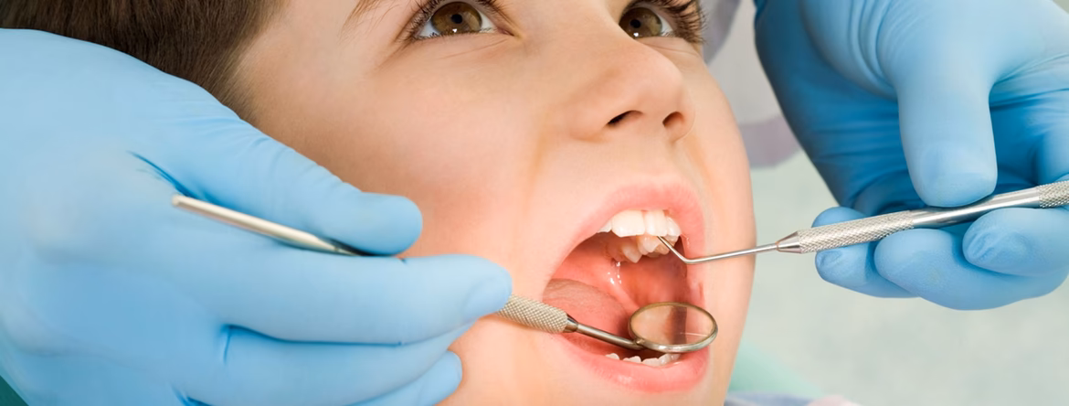 Como funciona o cheque-dentista para grávidas?