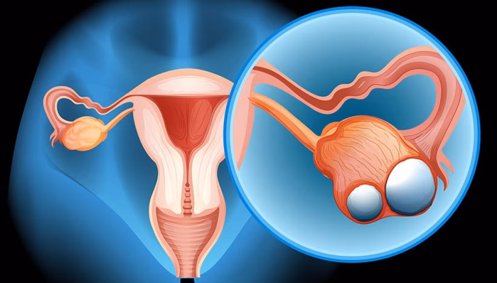 Quais são as principais doenças do sistema reprodutor?